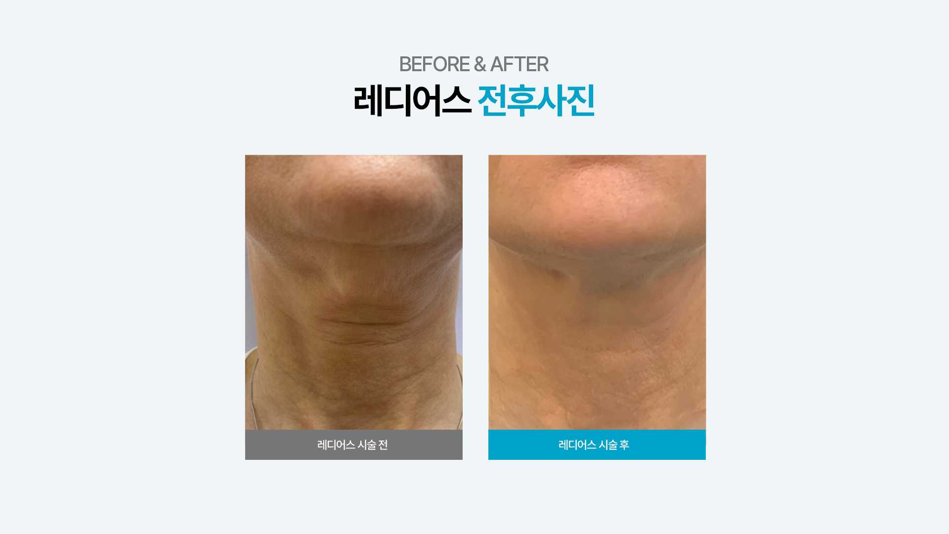 f320a614f112007f04f0020a43361b94_1735623039_7674