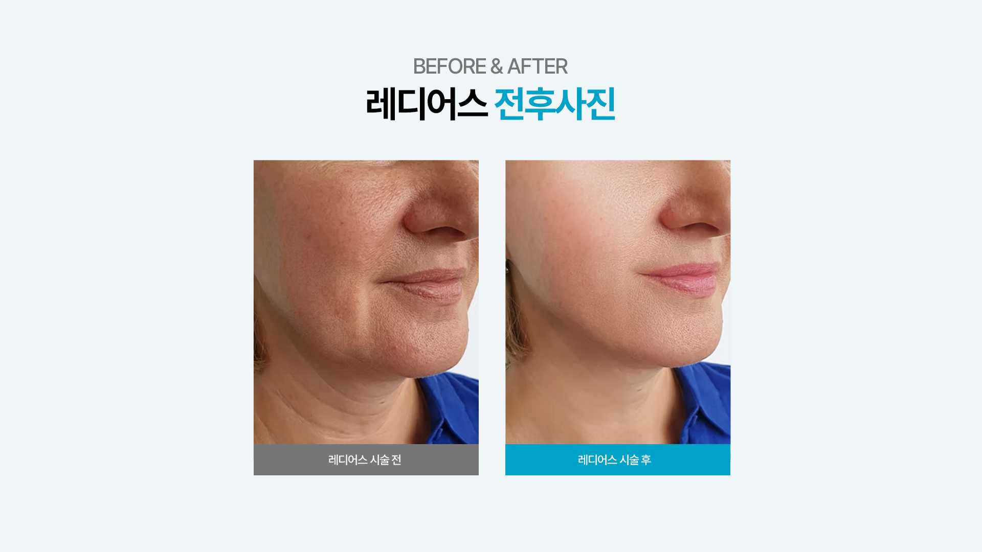 f320a614f112007f04f0020a43361b94_1735623039_8495