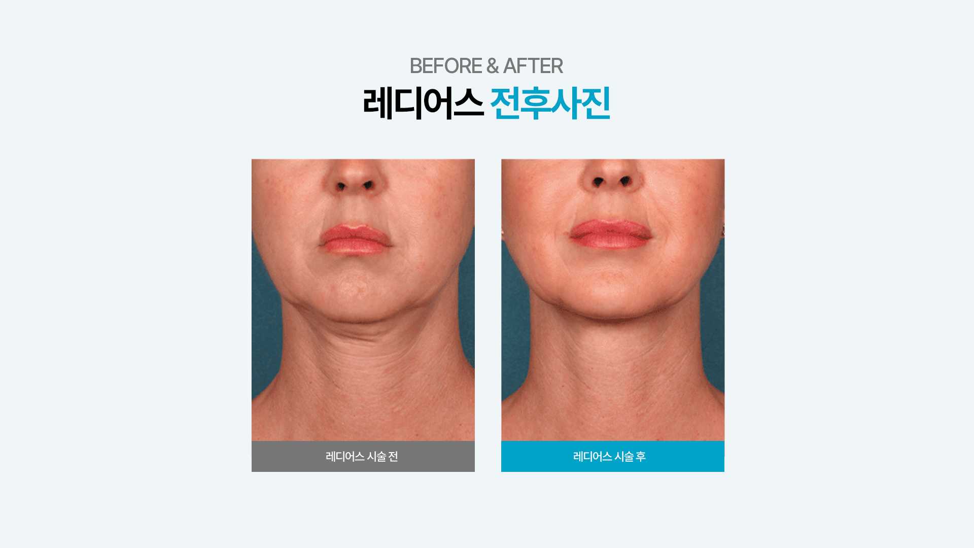 f320a614f112007f04f0020a43361b94_1735623039_9461