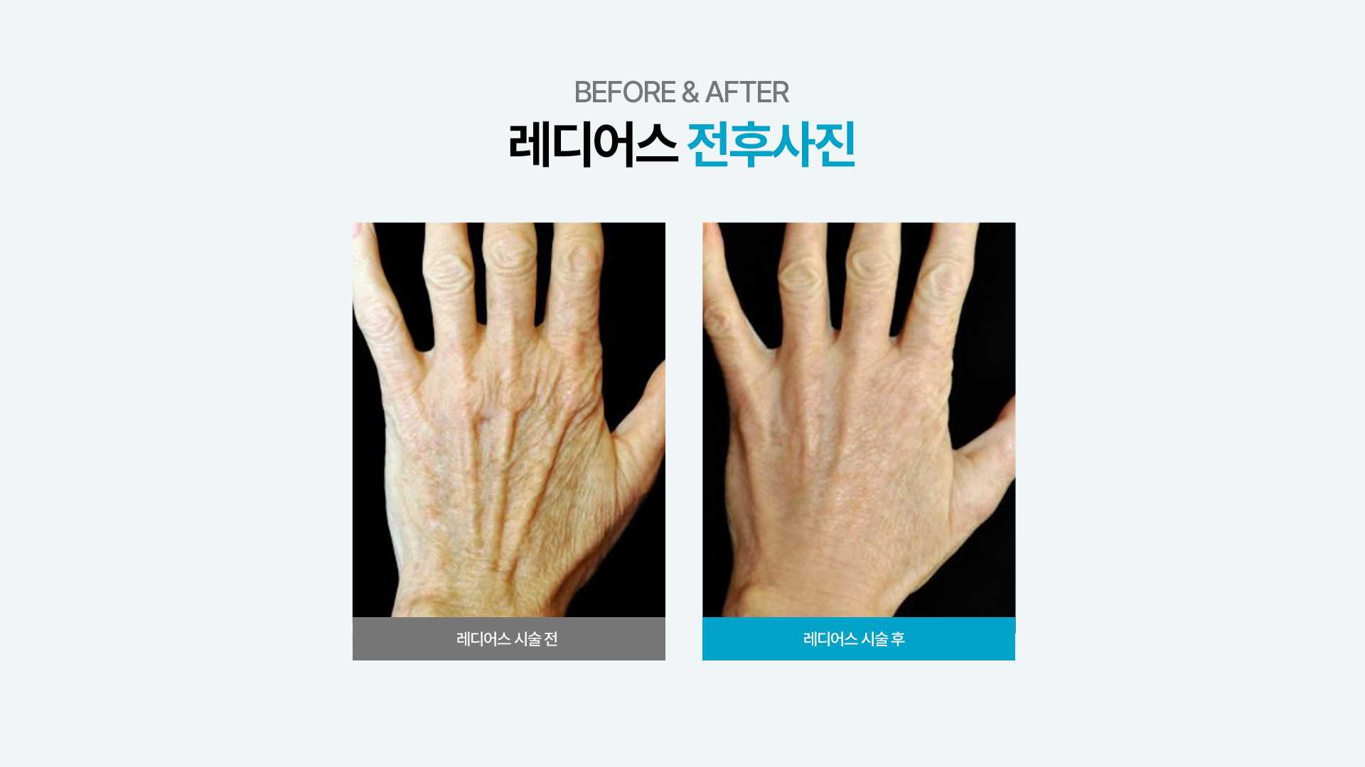 f320a614f112007f04f0020a43361b94_1735623040_0233