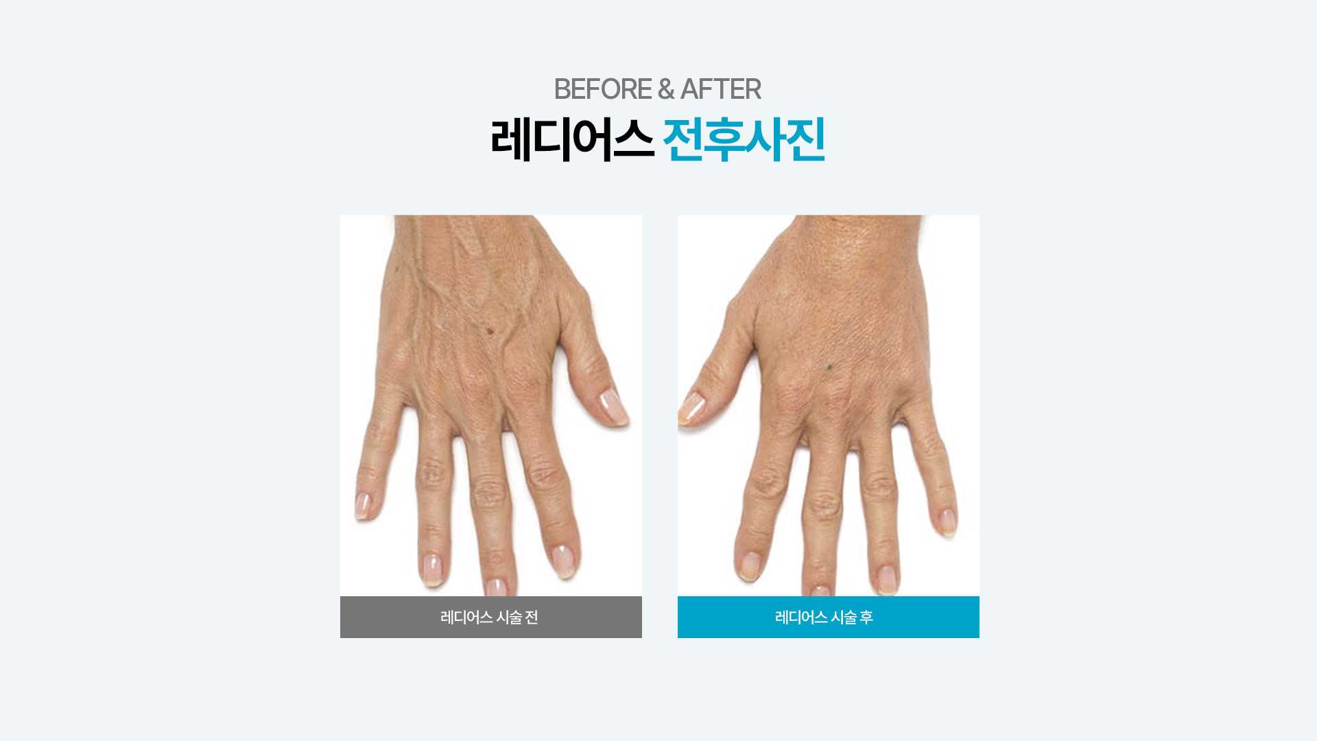 f320a614f112007f04f0020a43361b94_1735623040_0927