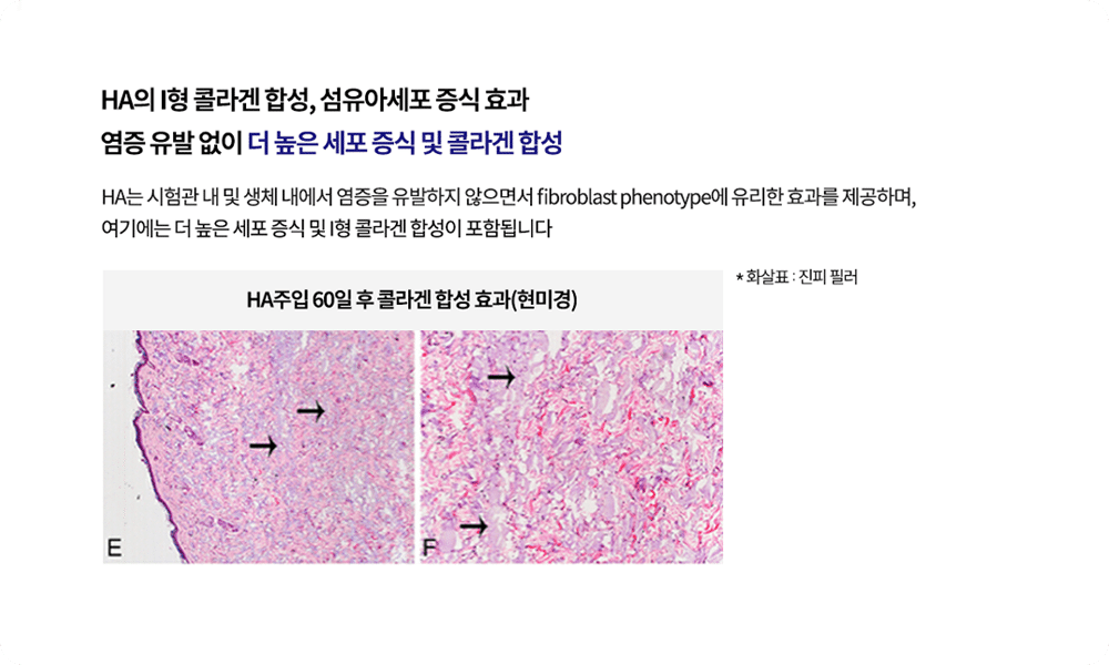 point04-1수정2